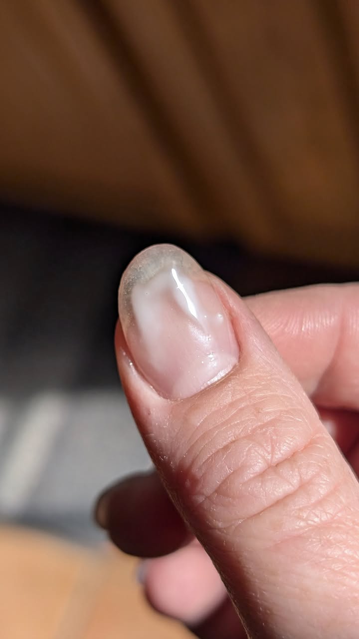 PEEL BASE